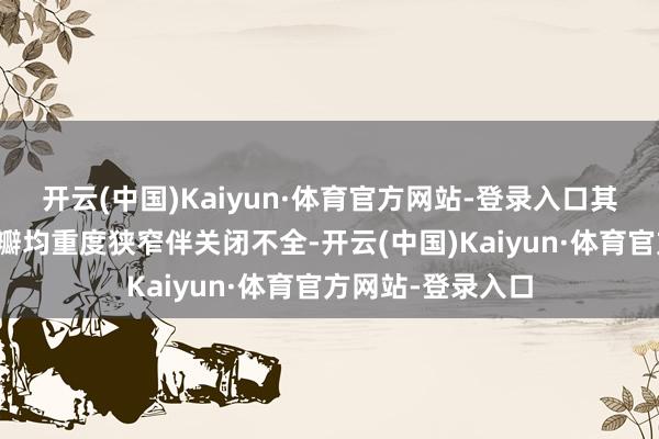 开云(中国)Kaiyun·体育官方网站-登录入口其二尖瓣及主动脉瓣均重度狭窄伴关闭不全-开云(中国)Kaiyun·体育官方网站-登录入口